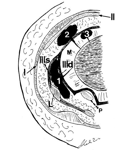 icd 10 code for synovial cyst unspecified